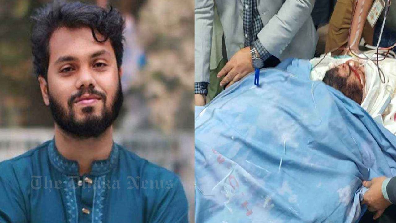 Brain swelling has not subsided, Hadi is at the crossroads of life and death: Doctors